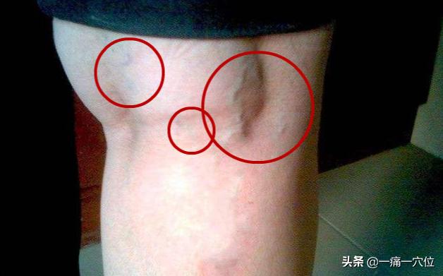 足跟疼痛，掐掐手这个部位可调理，简单有效，早看早受益！