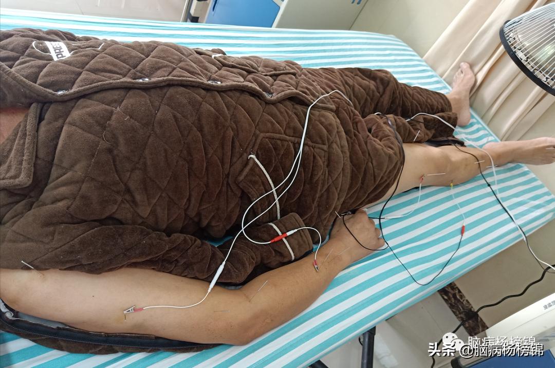 高空掉落脑出血,高处作业会不会引起脑溢血