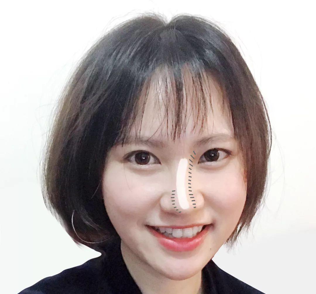 怎么修容把蒜头鼻修成好看的鼻子,鼻子本身就好看怎么修容