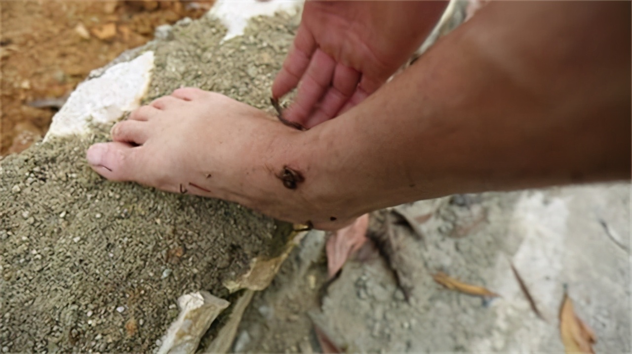 被蚂蟥钻身体里到底有多恐怖,蚂蝗能进入人的大脑里吗