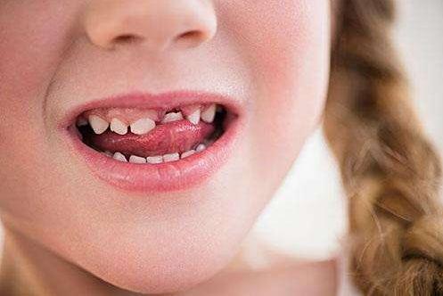 孩子牙不好是缺什么,小孩牙不好是肚里缺营养吗