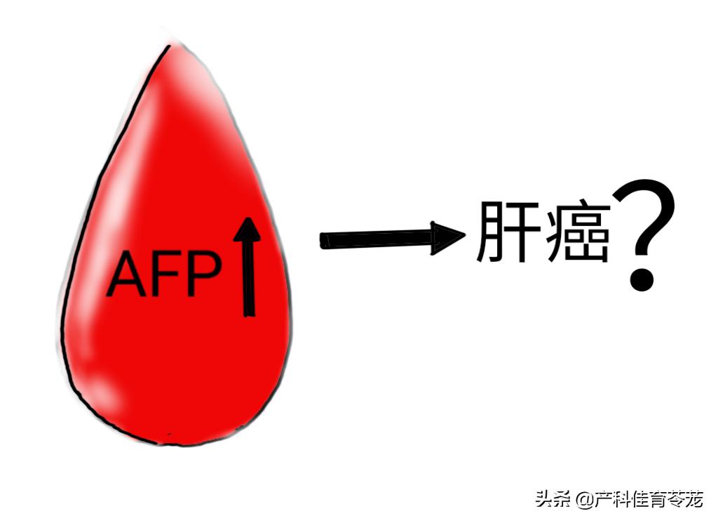 肿瘤标志物是甲胎蛋白,如何看肿瘤标志物系列之甲胎蛋白