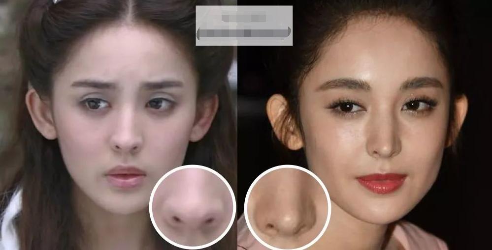 如何分辨鼻子整没整过,如何辨别鼻子有没有整过