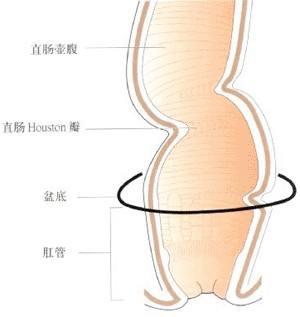 “医生，总感觉肛门不舒服，像夹了个东西，是咋回事？”
