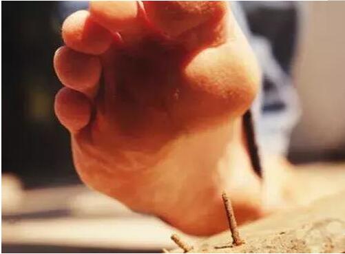 意外受伤一定要打破伤风针吗,受伤后几天内打破伤风针有效