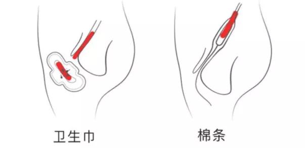 散装卫生巾“火”了……怎么挑才能远离妇科病？