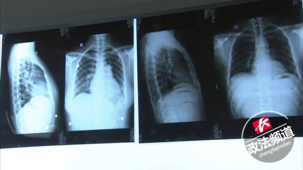 “穿着纸尿裤的女孩们,正在悄悄花钱买死”