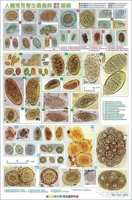 大便常规检查都有哪些,大便常规检查包括哪些