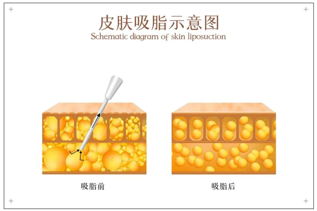 如何有效提升面部年轻化,怎么样保持脸部年轻的状态