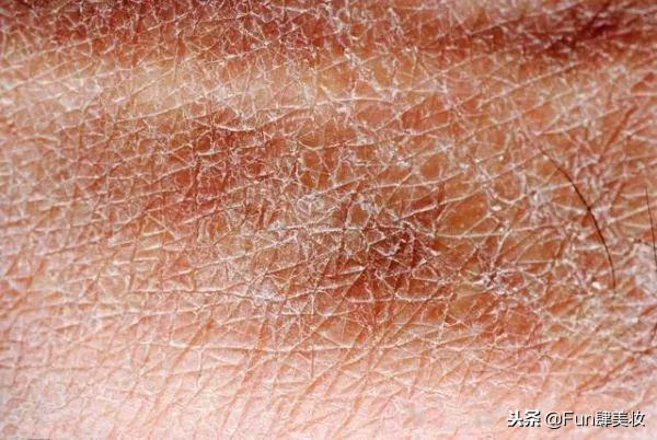 别瞎忙了！真正的好皮肤是这样养出来的！