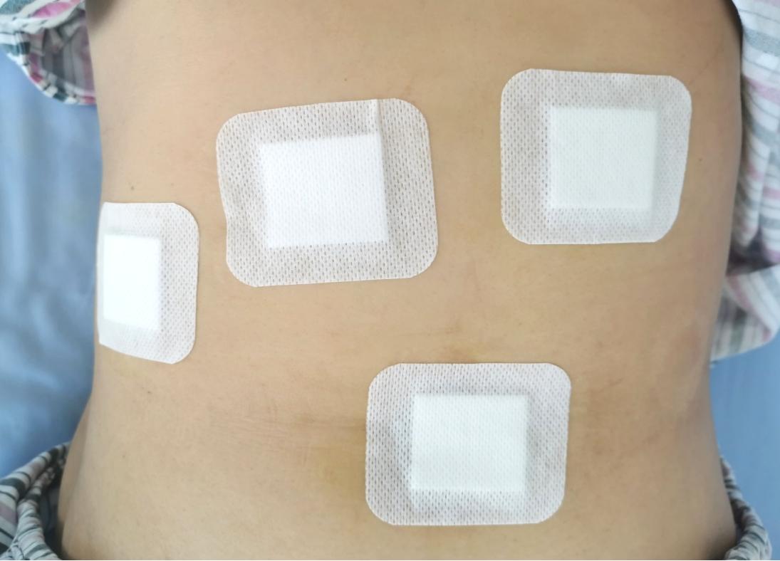 肝血管瘤为什么要切除胆囊,肝脏血管瘤微创手术需要住院吗