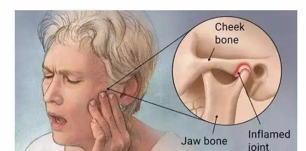 热水袋敷脸能缓解颞下颌脱位吗?