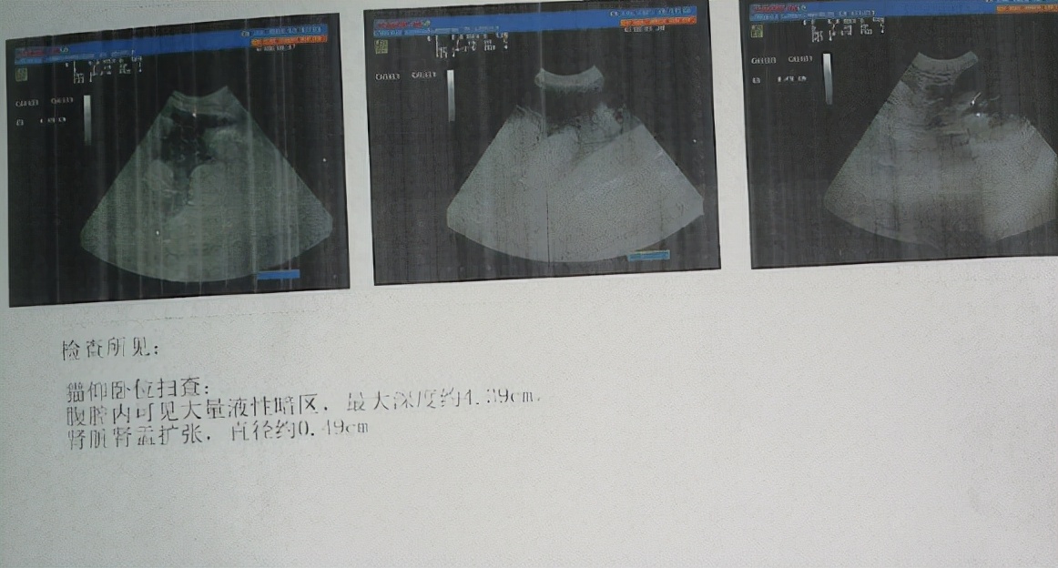 猫咪为什么绝育后还会叫,泰迪公犬做完绝育手术后还发情吗