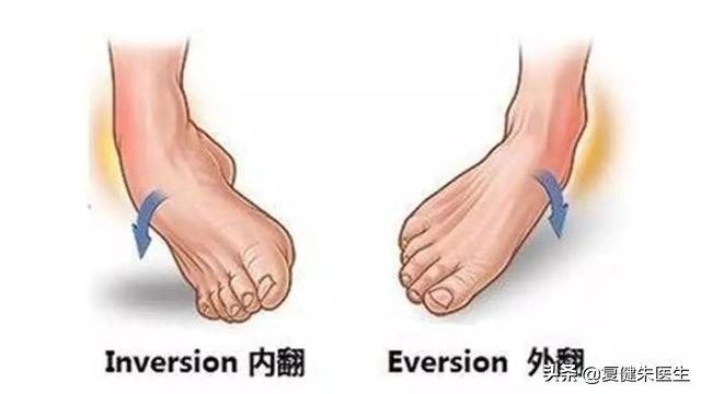 踝扭伤的康复治疗最佳疗法,踝扭伤妙招