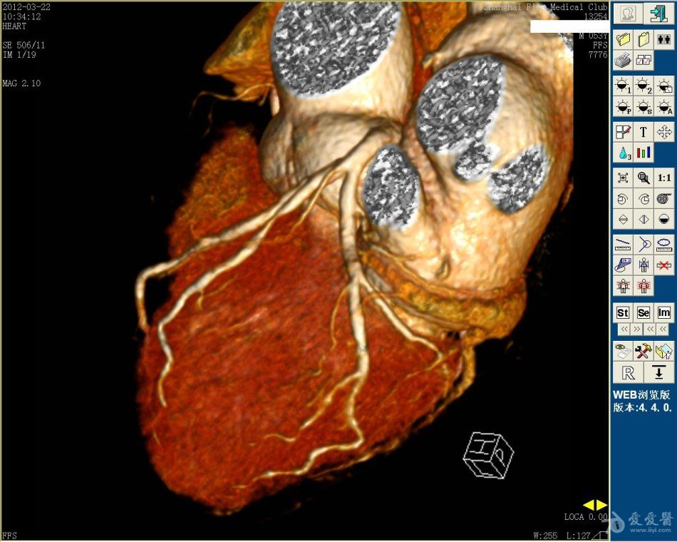 冠心病治疗中医讲座,冠心病中医药健康干预