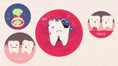 牙科不告诉你去牙结石的秘密,牙结石科普