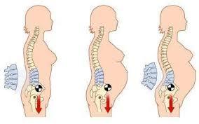 缓解产妇腰痛的有效方法,产妇腰痛是怎么缓解