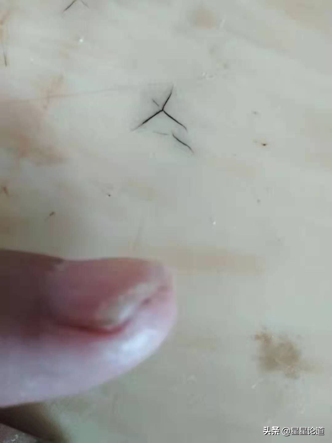 指甲盖劈了怎么办,指甲盖剪破了怎么办