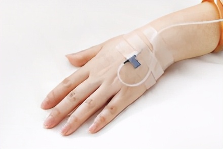 全身型重症肌无力预后,胆碱酯酶治疗重症肌无力的原理