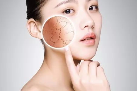 脸干刺痛是什么原因引起的,手干脸干是什么原因呢