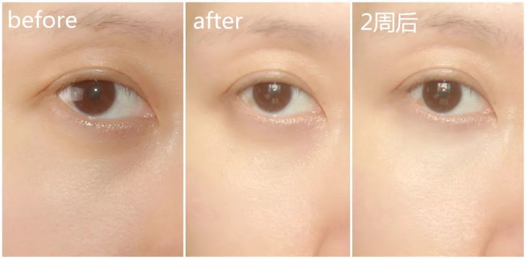 兰蔻彩妆明星同款产品有哪些,兰蔻明星大红瓶