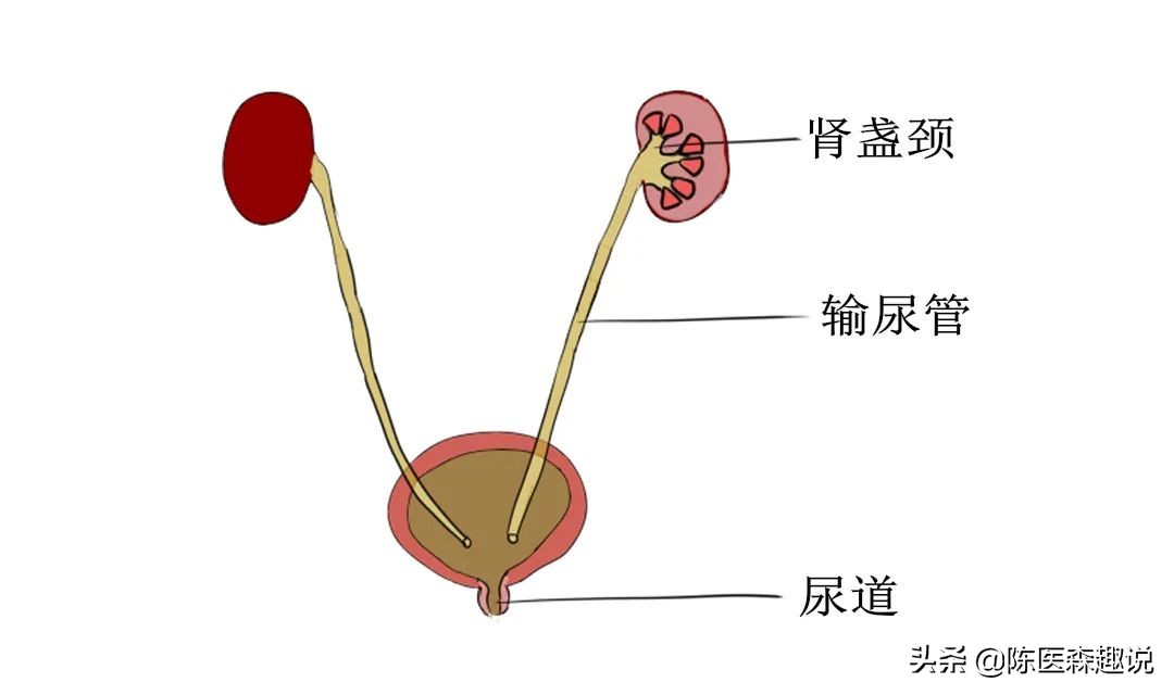 0.7厘米肾结石该怎么治,0.7厘米的肾结石怎么治疗