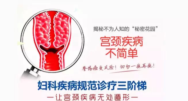 更年期女性要做hpv和tct检查吗,女性做hpv和tct检查前注意事项
