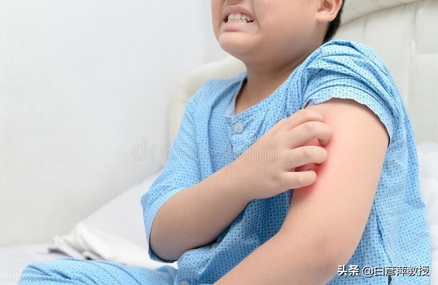 皮肤科医生眼中的真相,皮肤科激素皮炎