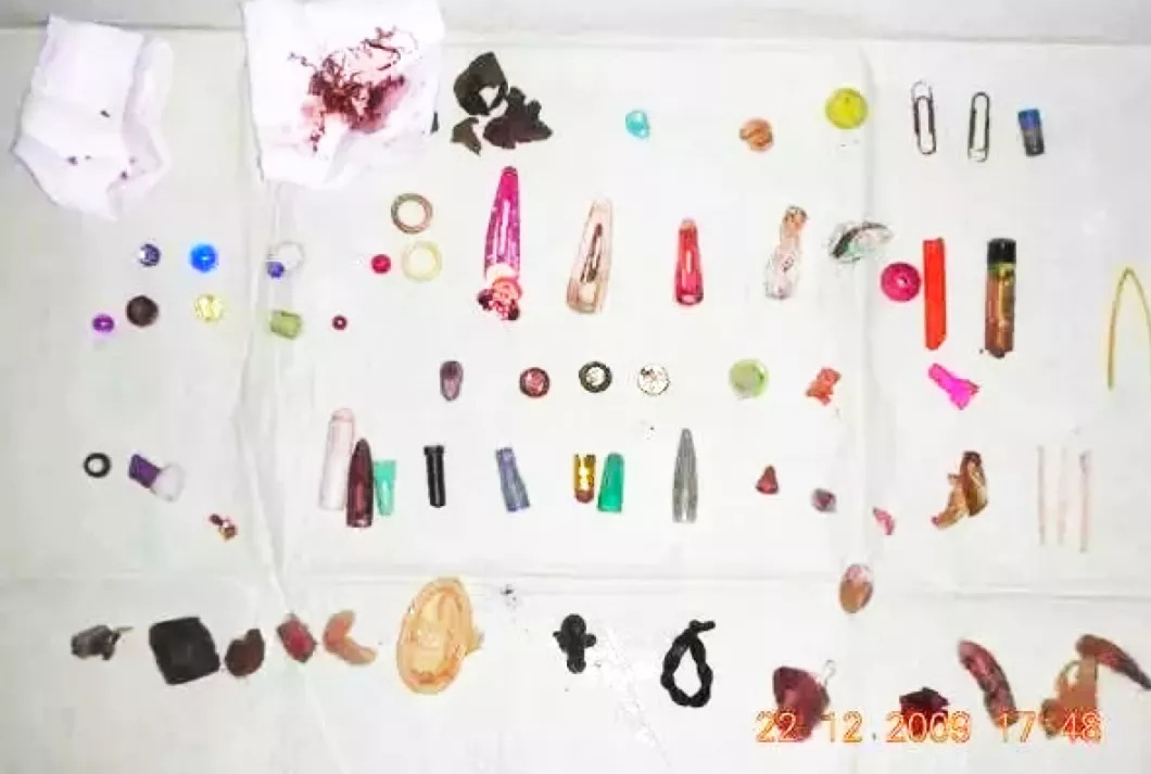 濂崇浣撳唴涓嶆槑鍘熷洜鍑鸿,濂崇浣撳唴绐佺劧鍑鸿