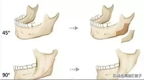 脸大真的不如脸小的好看吗,脸小真的显瘦吗