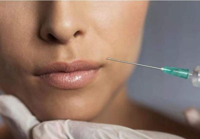 女人打玻尿酸的表现,女人经常打玻尿酸10年