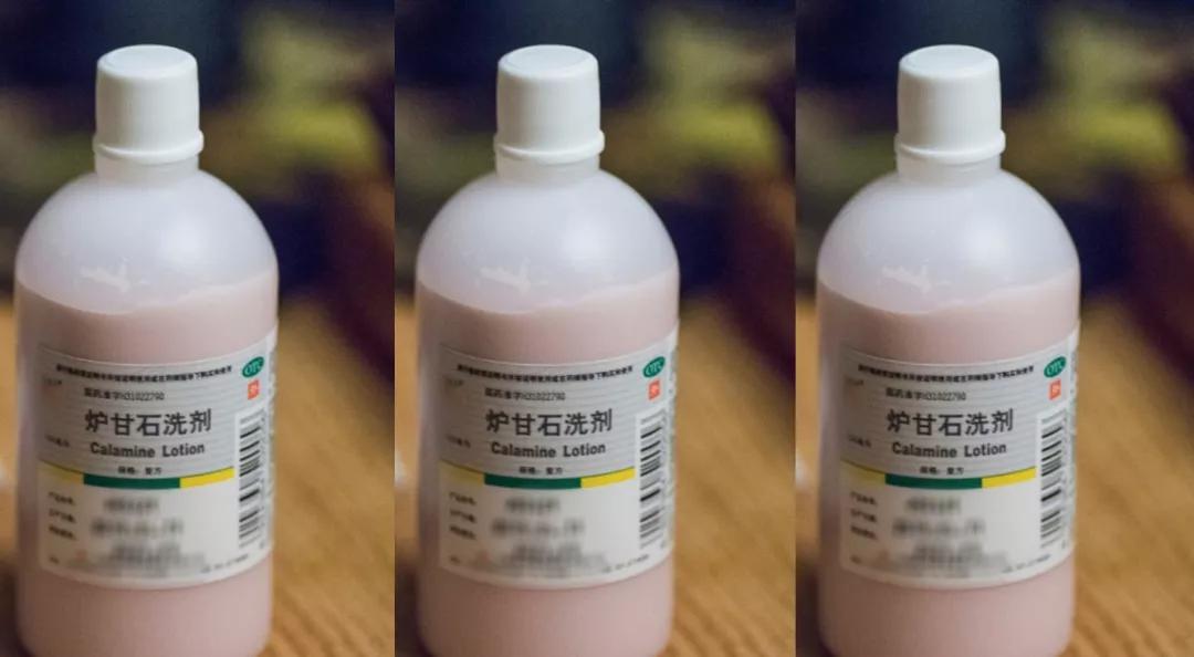皮肤过敏发痒可以用炉甘石洗剂,儿童皮肤问题擦什么面霜