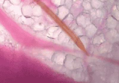 咬人的虫子跟蚂蚁相似,相似于毛毛虫又会咬人的虫子