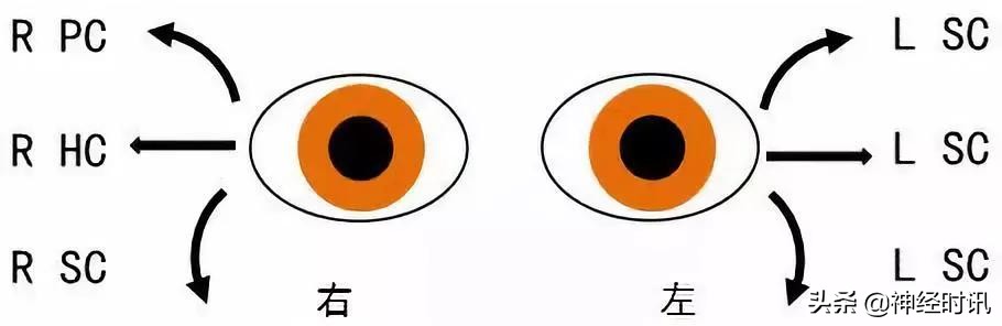 位置性眩晕手法复位示意图,位置性眩晕鉴别诊断