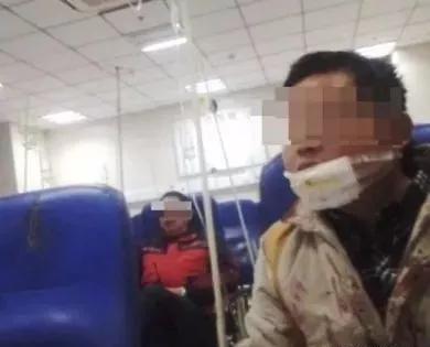 砂轮机会伤人吗,砂轮机伤人怎么防护