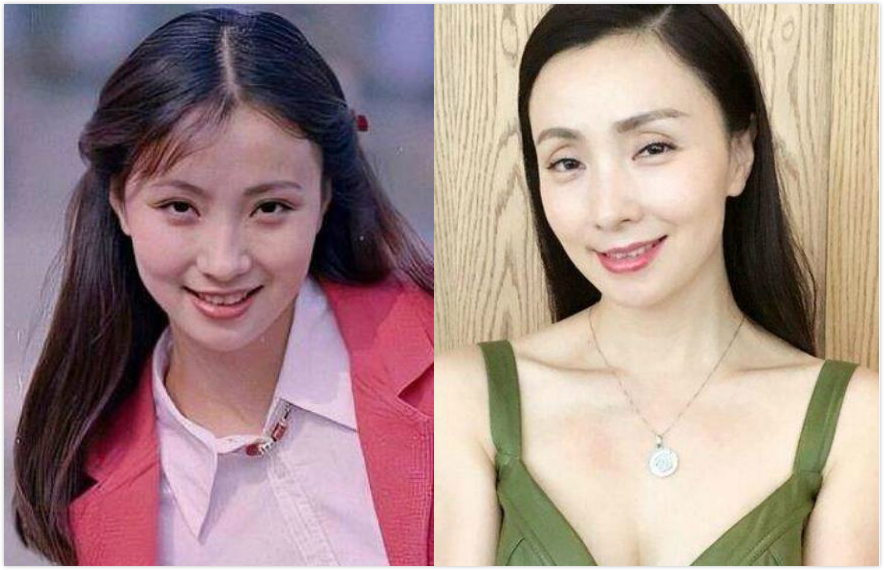 单眼皮、龅牙、厚嘴唇，这些缺陷美才是娱乐圈该有的百媚千红