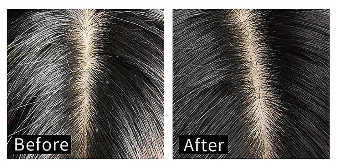 袁咏仪推荐的洗发水牌子,这款洗发水真的那么好吗