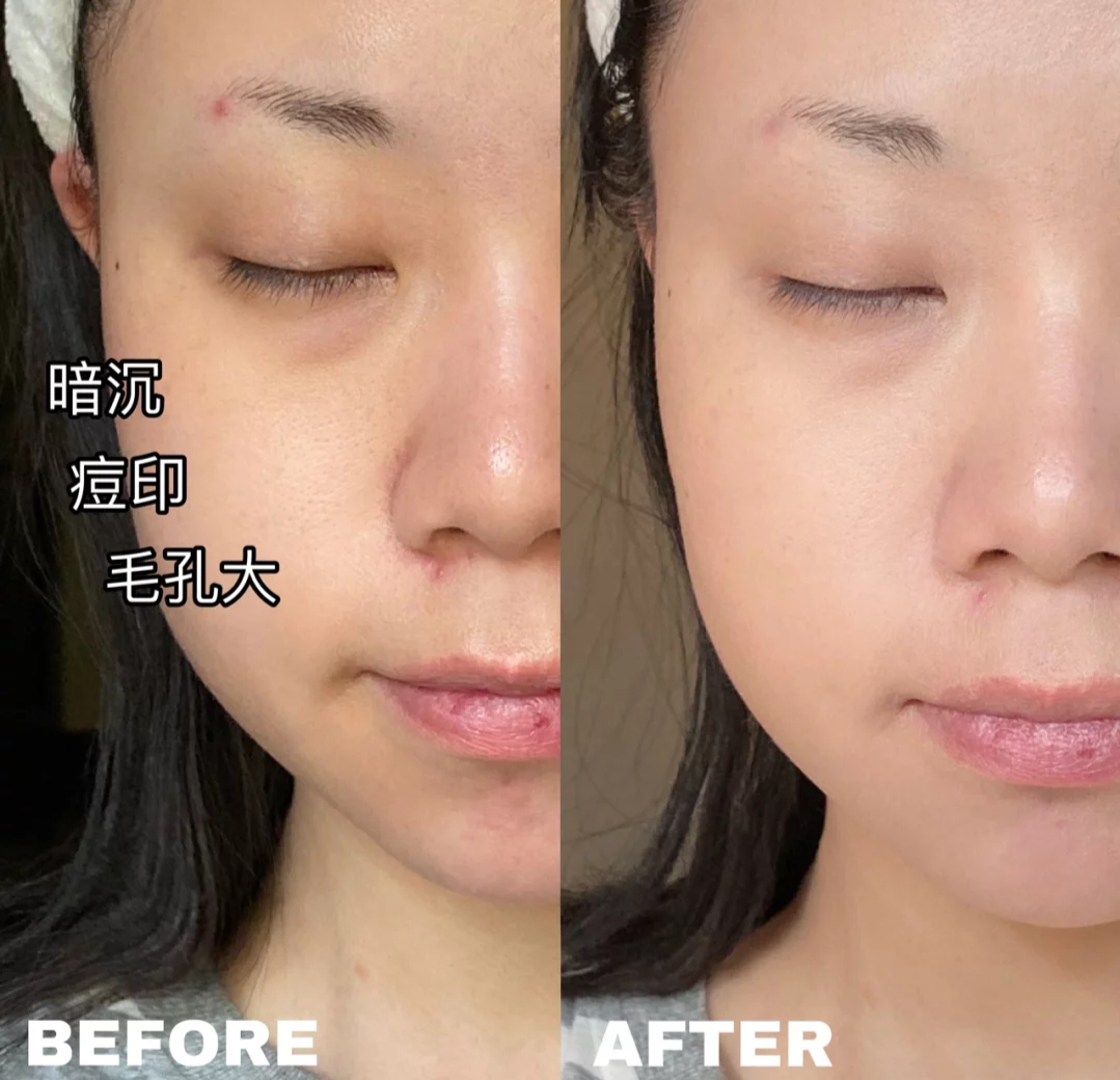 油痘肌阿玛尼粉底液测评,tf粉底液柔雾无痕粉底液