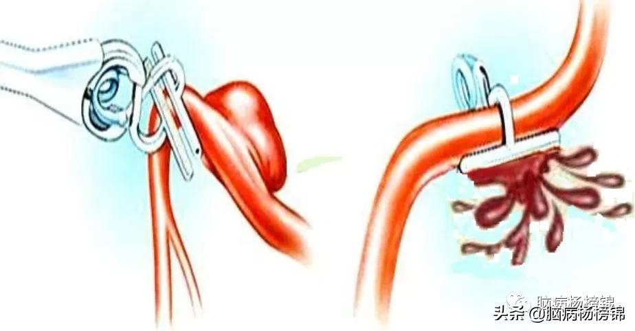意外伤害很严重年纪轻轻难保命，谭院刀刀用真情豫南名医中中中