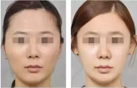 整形大师故事,整形医生真实案例