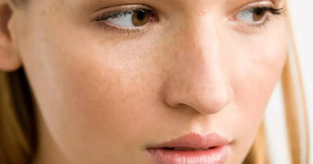 脸上的斑一直去不掉是怎么回事,脸上的色斑一直不消怎么办