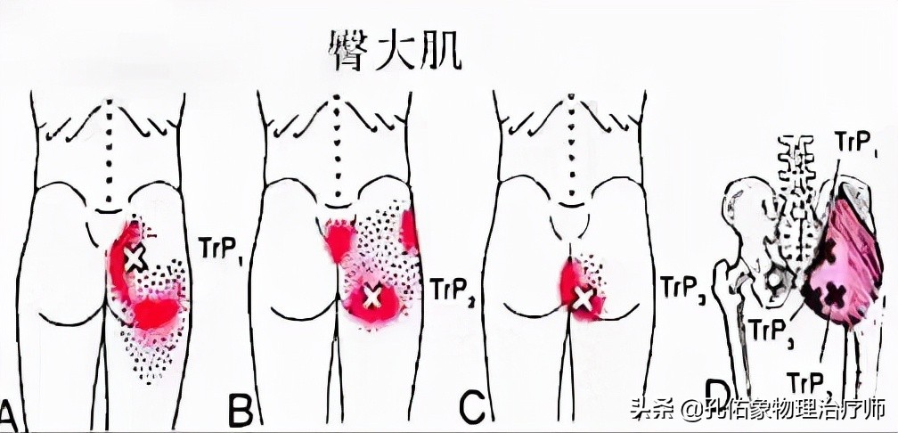 老年人腿脚无力要怎么避免,专治老年人下肢无力的方法