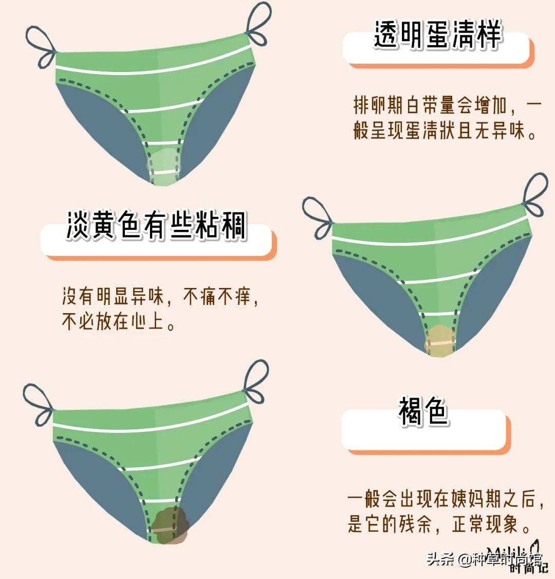 裤上黄黄的还有异味是怎么回事,裤内有淡黄分泌物无异味