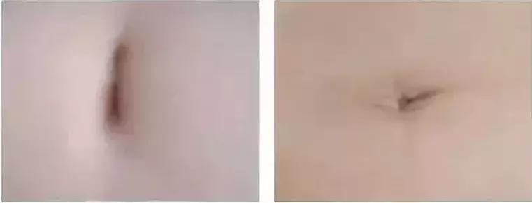 最重要的穴位对应病症,各种疾病的穴位压痛点