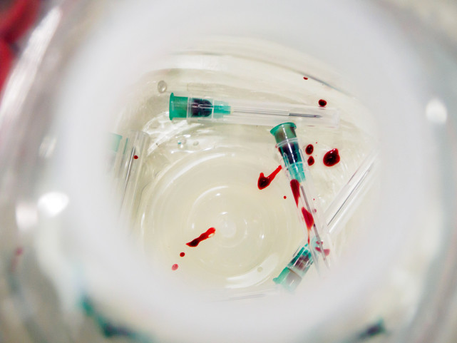 交往之前，如何知道对方有没有艾滋病？