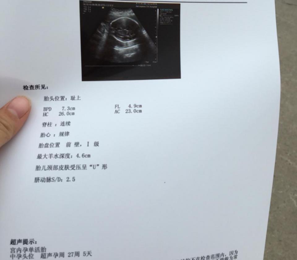 孕28周后产检主要查什么,孕33周5天孕妈提醒