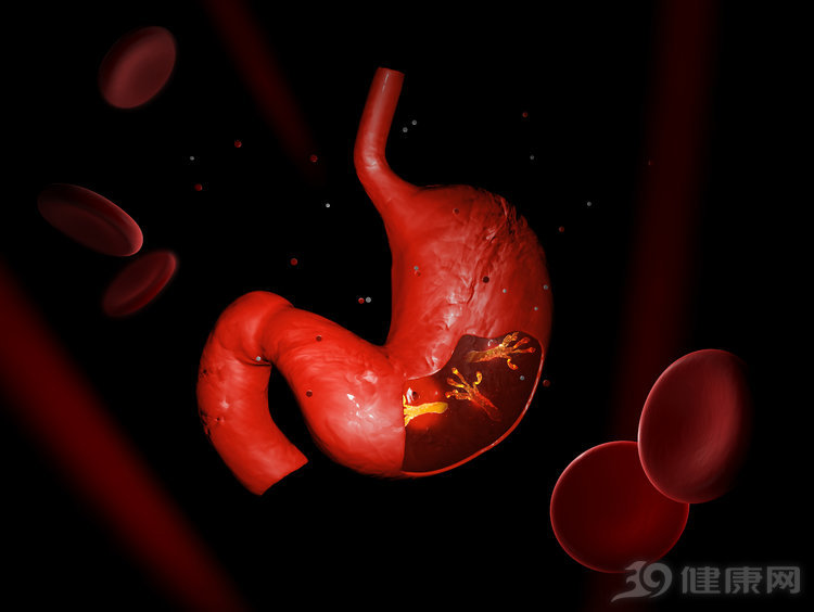 幽门螺杆菌最怕什么中药材,幽门螺杆菌的危害你真的了解吗