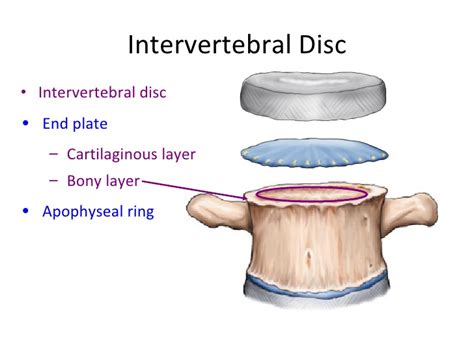 椎间盘的恢复,椎间盘恢复生理曲度方法