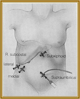 胆结石会引起黄疸腹疼吗,胆结石胆囊炎伴有黄疸应该怎么办