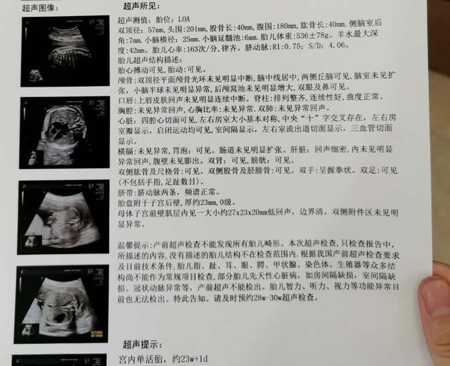 记录孕早期检查结果分析,记录孕十月